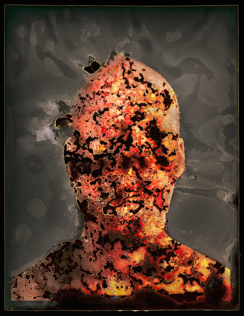 Self-portrait created through biological imaging with buried color negative showing frontal bust with upward gaze amid intense decomposition. Image displays fiery reds, golden yellows, and black voids from chemical reactions with extensive cellular texturing and honeycomb-like perforations from extended soil processing.